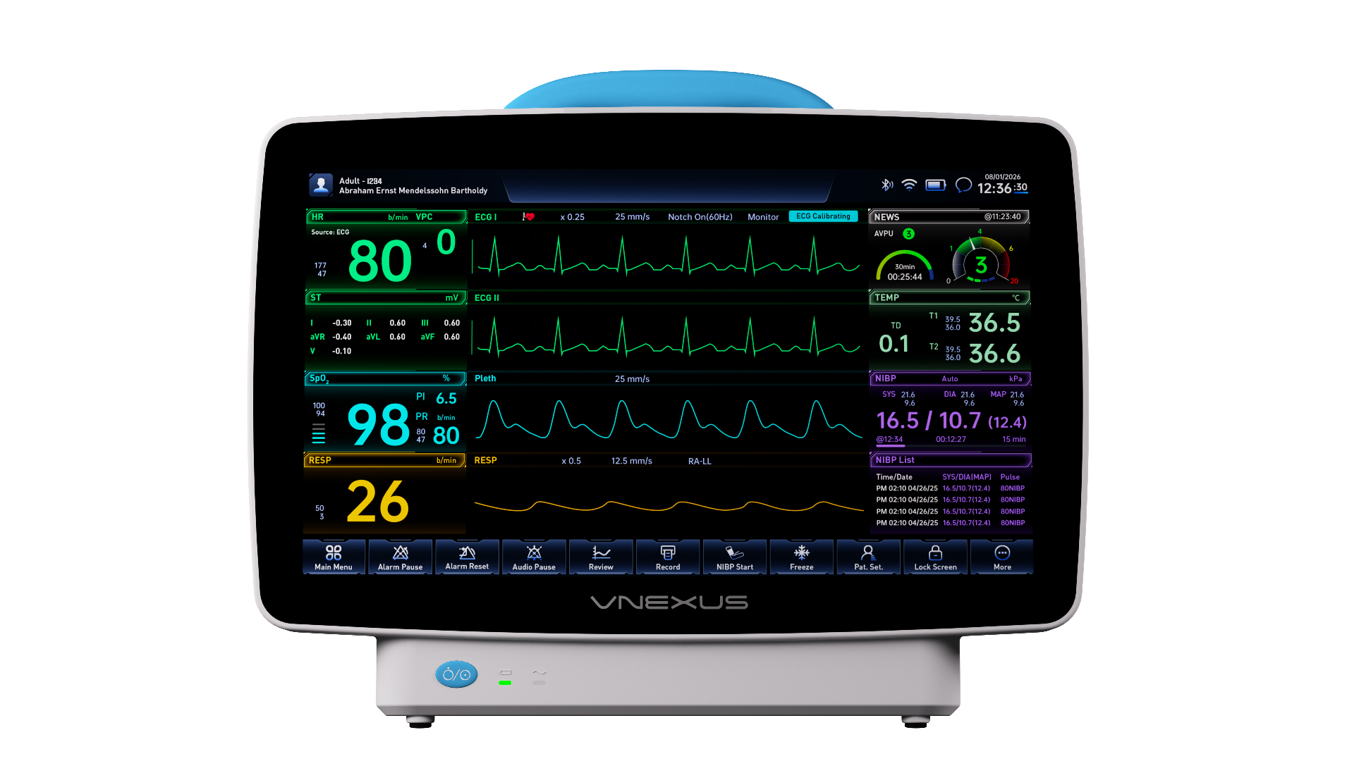 Patient Monitoring